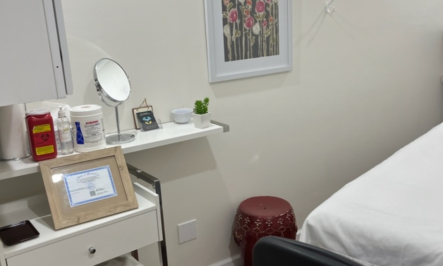 Image 2: Zero Downtime Chemical Peel Deals: 1, 2, or 3 Sessions at Regen