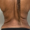 Image 3: 64% Off Total Body Contouring with Lymphatic Drainage Massage