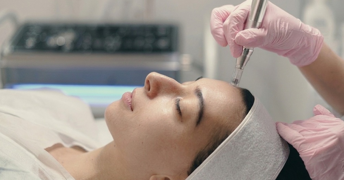 Tratamiento facial con Dermapen, peeling y radiofrecuencia en Barcelona