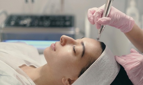 2 sesiones Rejuvenecimiento Facial: Dermapen con Peeling Químico; para nuevos usuarios