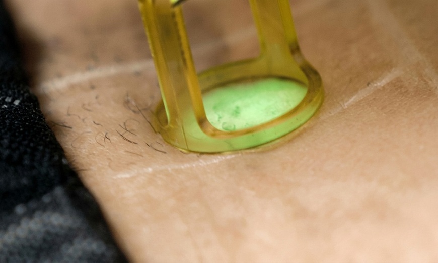 Image 7: Six Laser Hair Removal at SEV Laser, a Celebrity-Favorite Salon  