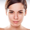 Image 4: Laser Lipo at Ultra Body Sculpt