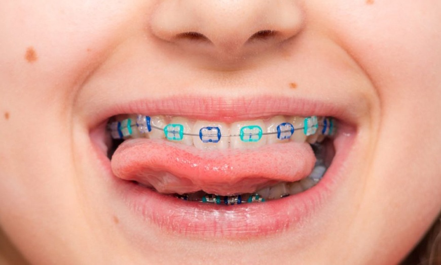 Image 3: Get a One Dental Exam, X-ray w/t Tooth cosmetic White Filling & More