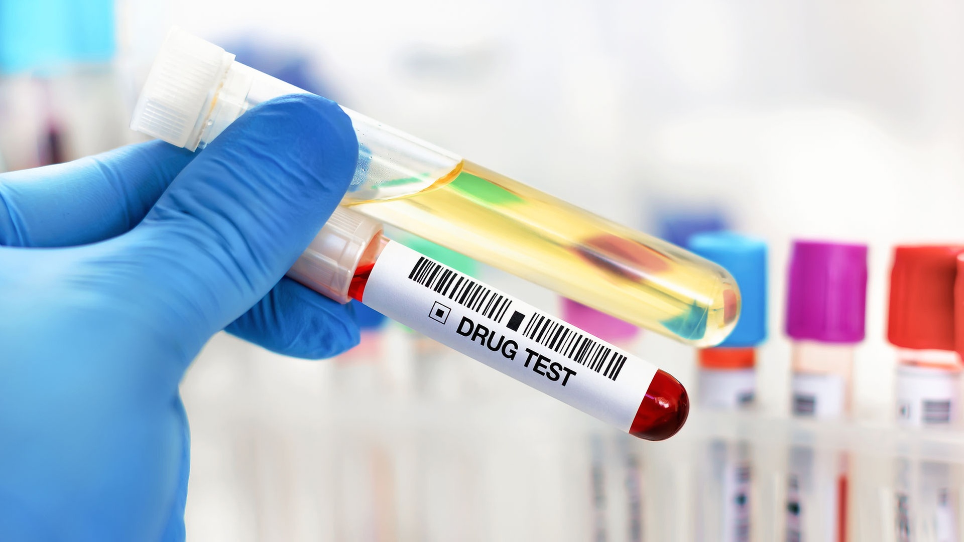 5-, 10- or 12-Panel Rapid Urine Test