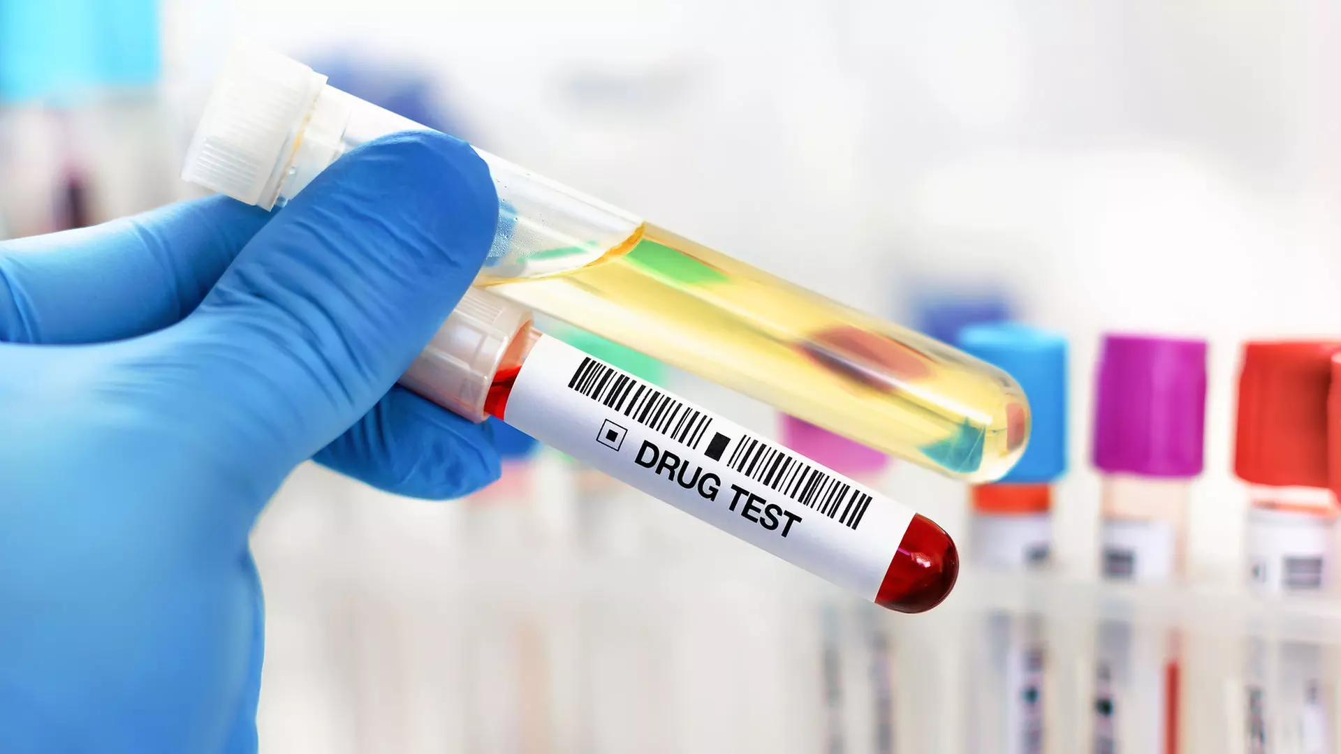 5-, 10- or 12-Panel Rapid Urine Test