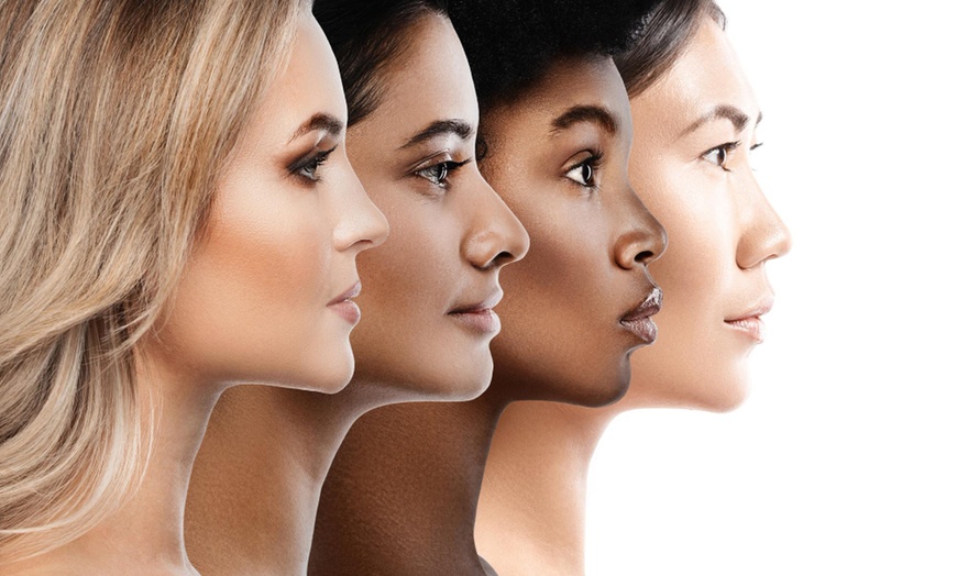 Image 2: Up to 80% Off on Ultrasound Skin Tightening (HIFU) at Golden Aura Salon