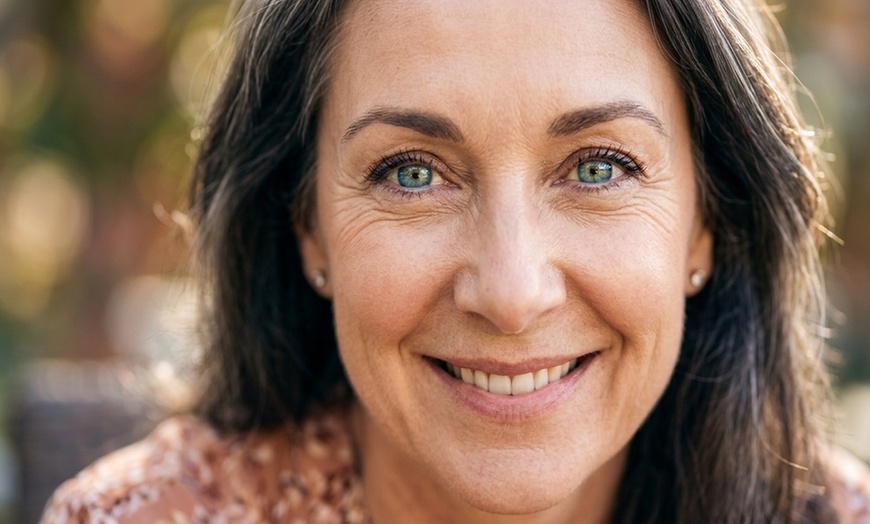 Image 2: Refresh Your Look: Blepharoplasty for Eyelids, Minibrow and Cheek Lift