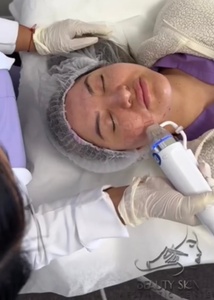 Hot Compress Massage Therapy - Elixir Glow spa