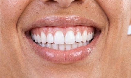 Dental Exam with Full Mouth X-rays and Basic Cleaning with Option for Deep Cleaning - Brookshire Dentistry