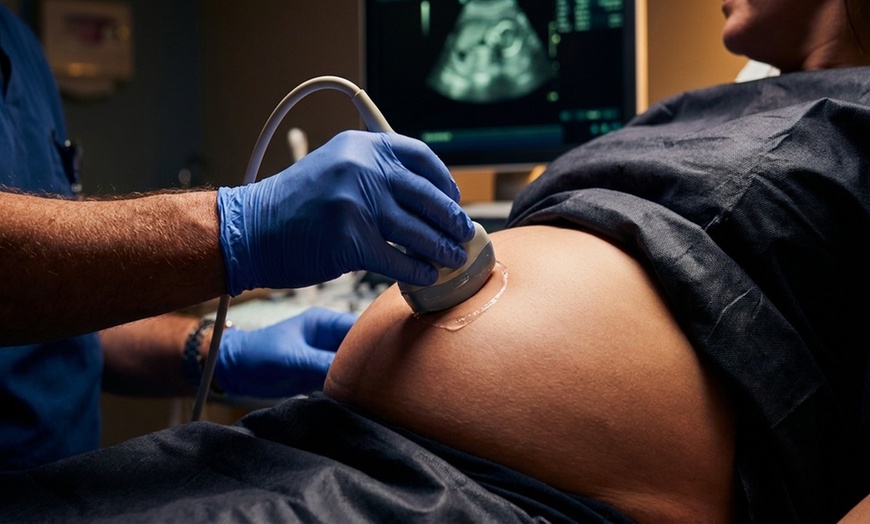 Image 5: Experience Babyview's 3D/4D Ultrasound Package for a Glimpse of Your Baby, Available with Up to 50% Discount