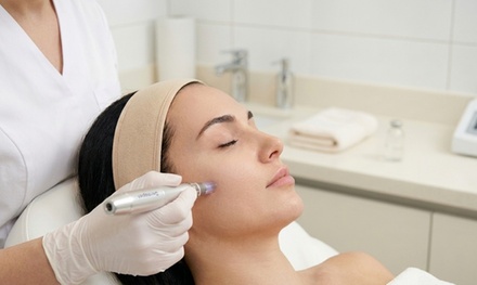 Dermapen 4 One Micro-Needling Treatment with PRP Facial - Aurora Advanced Aesthetics