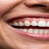 Image 8: Brighten Your Smile: Touch Up or Full-Service Teeth Whitening Session