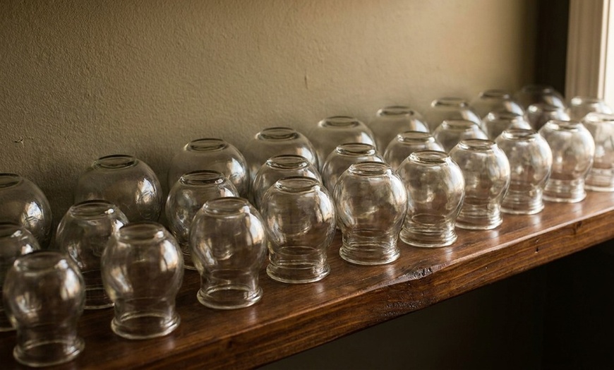 Image 6: Expert Acupuncture Consultation and Cupping Treatments