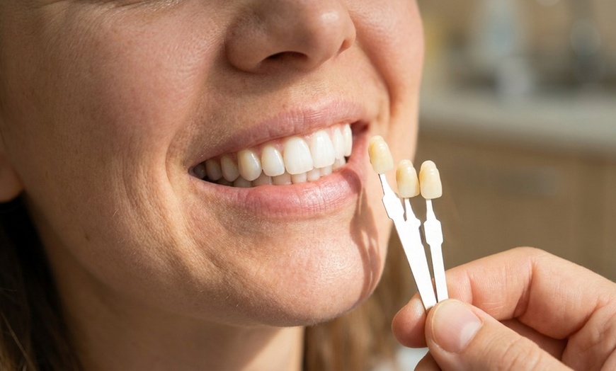Image 7: Brighten Your Smile: Touch Up or Full-Service Teeth Whitening Session