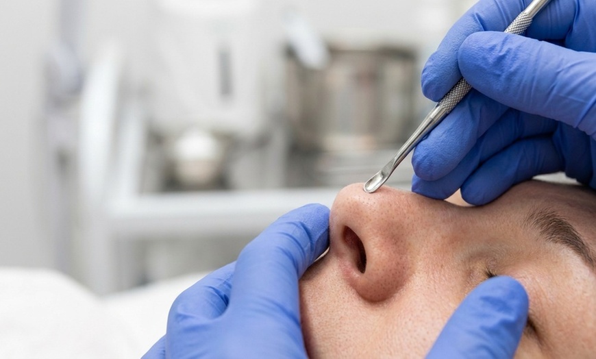 Image 4: Experience Hydrating Facial with Extractions for Radiant Skin