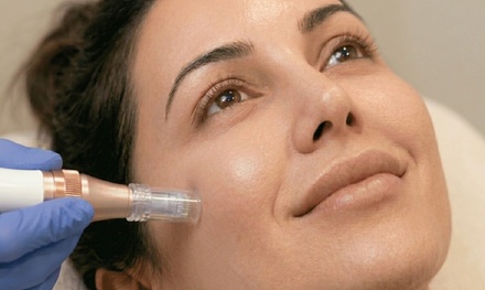 One Micro-Needling + PDRN Serum Treatment - Vivid Centre Medspa And Wellness