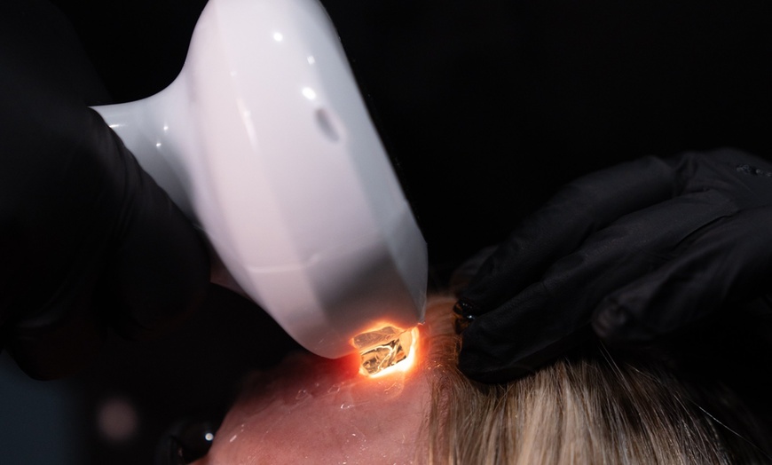 Image 10: Forma Facial, IPL Facial, COOLPeel, or Facial Salmon DNA