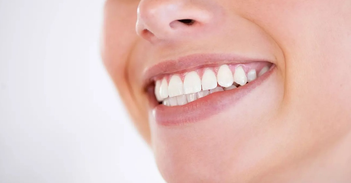 Implantes dentales de titanio, higiene bucal y radiografía en Valencia