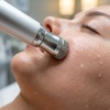 Image 3: Up to 88% Off on Microdermabrasion at Love You Laser