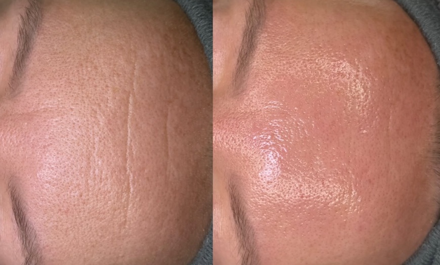 Image 3: Revitalizing Lymphatic Massage & Facial for Radiant Skin