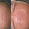 Image 3: Revitalizing Lymphatic Massage & Facial for Radiant Skin