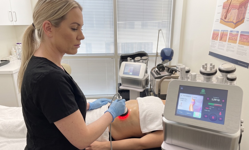 Image 5: Ultrasonic Cavitation & Radio Frequency Skin Tightening