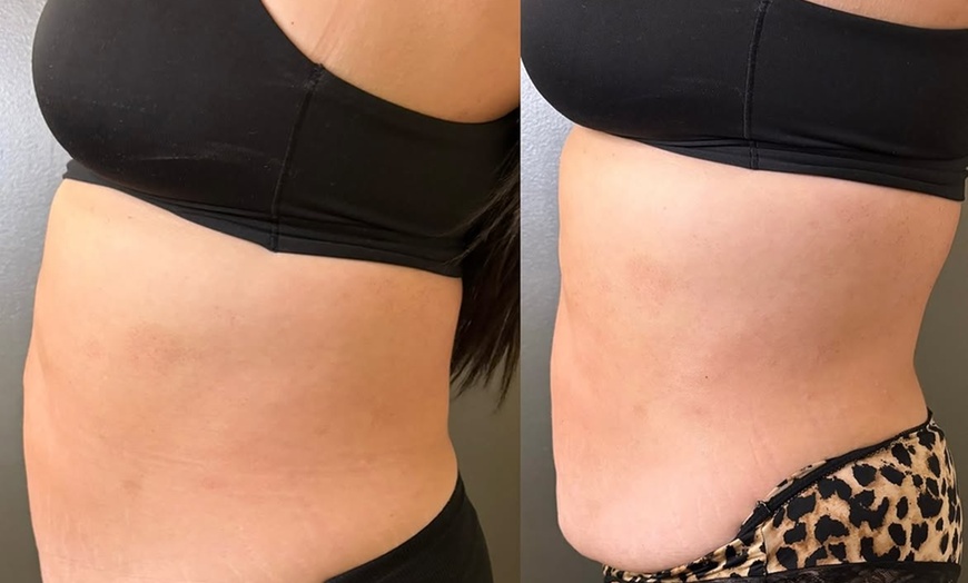 Image 2: Relax with 60-Minute Lymphatic Drainage: Choose 1, 3, or 5 Sessions