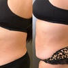 Image 2: Relax with 60-Minute Lymphatic Drainage: Choose 1, 3, or 5 Sessions