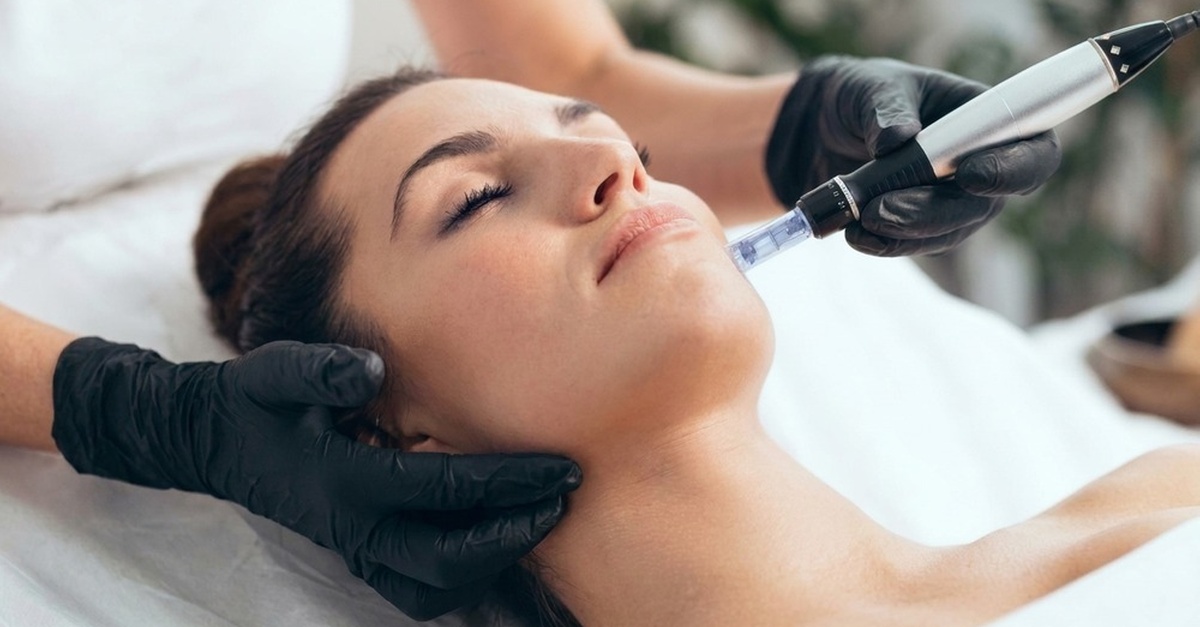 Tratamiento facial con Dermapen en Bilbao