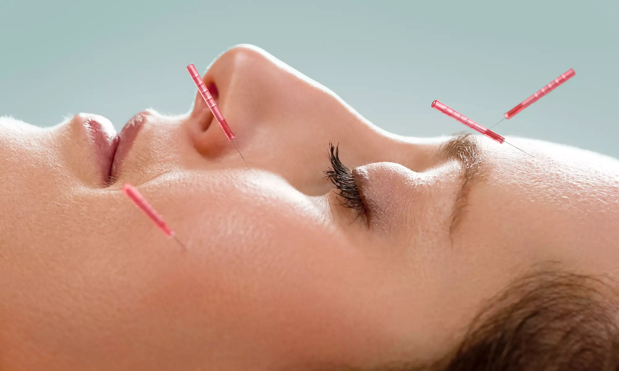 One or Three Acupuncture Treatments at Sandy Acupuncture & Chiropractic Clinic (Up to 44% Off)  - Primary Image