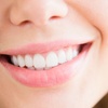 Image 2: Laser Teeth Whitening for a Brighter Smile