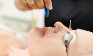 Laser Skin Resurfacing Laser Skin Resurfacing