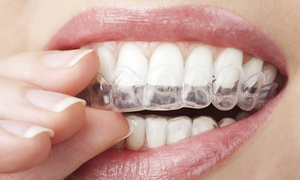 Self Braces Clear Aligners