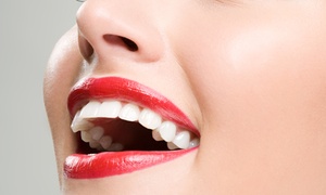 Clínica Dental El Espinar: 1 o 2 sesiones de blanqueamiento dental con luz led y limpieza bucal desde 49,90 € en Clínica Dental El Espinar