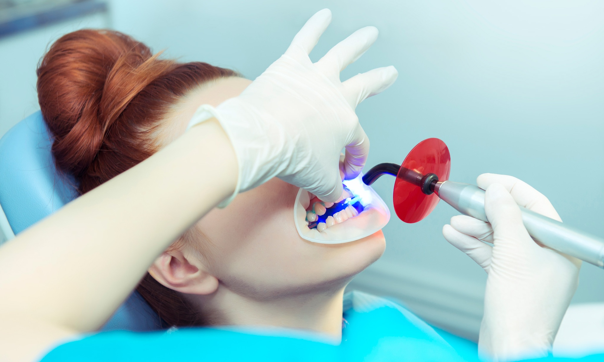 Get a Brighter Smile with 30-Minute Teeth Whitening Options