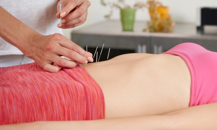 One Initial Health Consultation with Acupuncture Treatment - Acupuncture Associates of Plantation