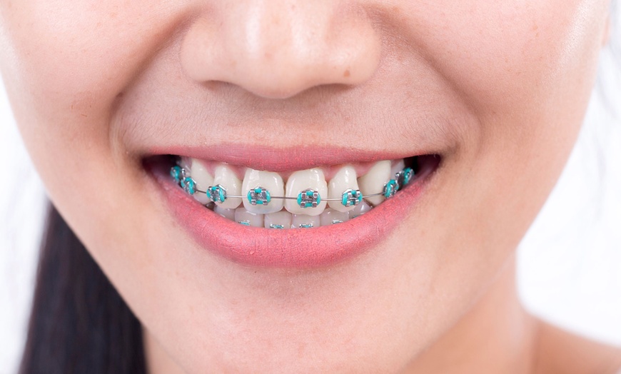 Image 1: Ortodoncia completa con brakets