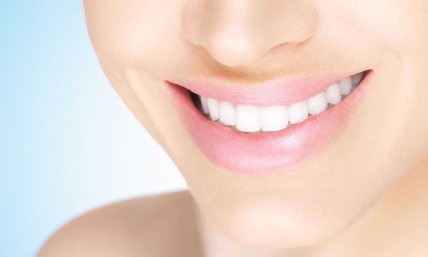 Image 1: In-Chair Teeth Whitening