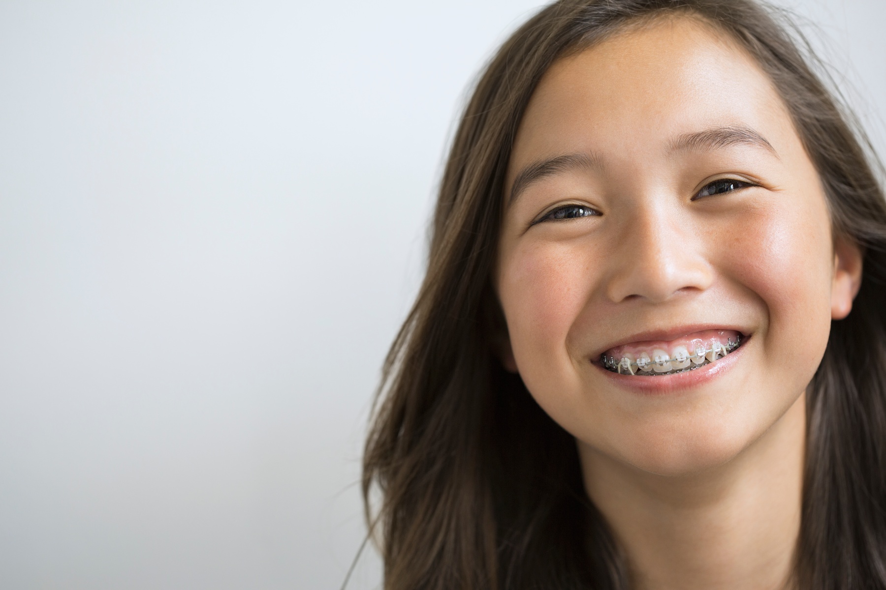 Up to 49% Off on Orthodontist at Your Covina Family Dentistry