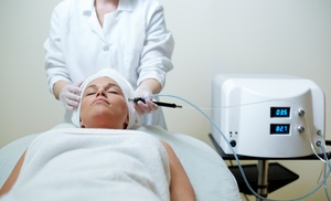 Microdermabrasion Facial