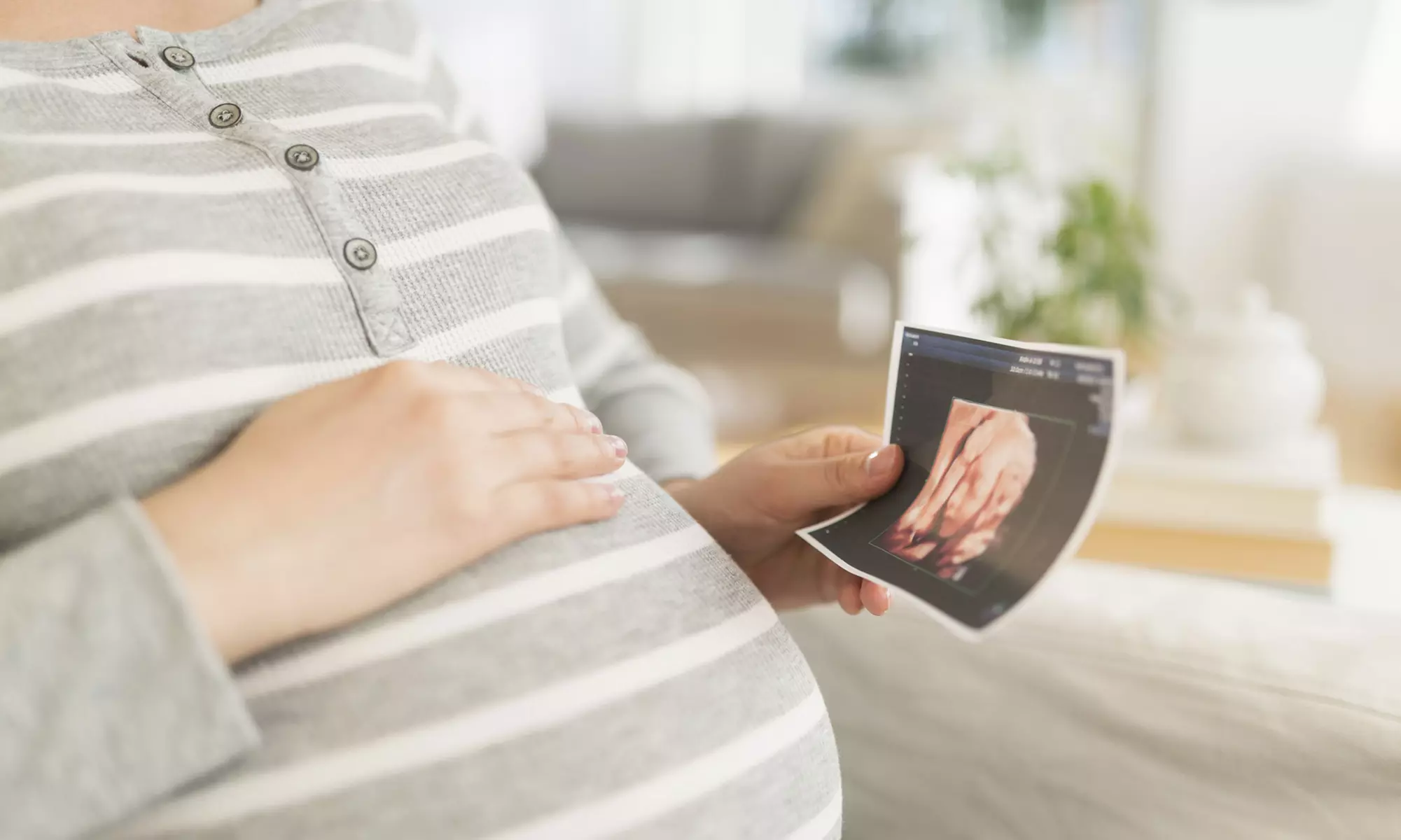Ultrasound Package at Maternal Memories 3D 4D Ultrasound (Up to 43% Off). Three Options Available. - Primary Image