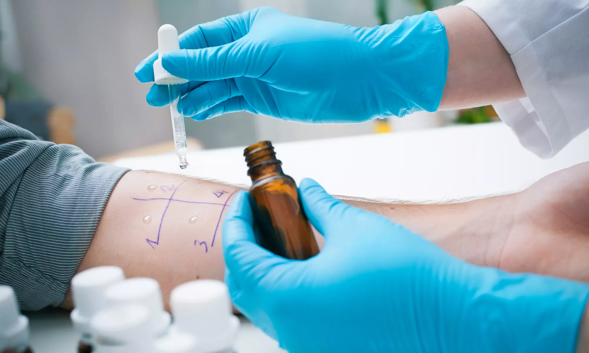 Up to 61% Off on Allergy/Food Intolerance Testing at Harmony In Health - Primary Image