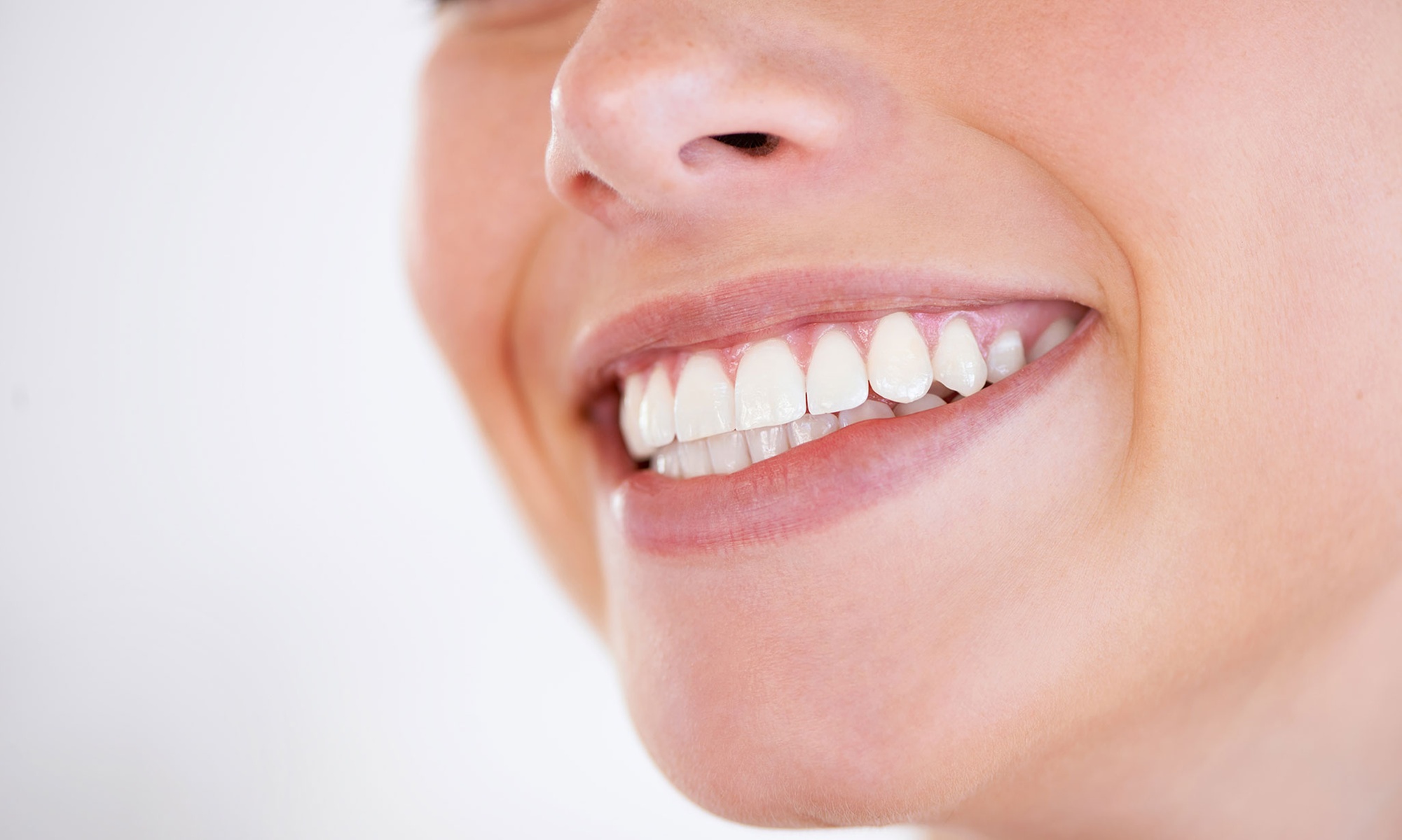 Implante dental y limpieza
