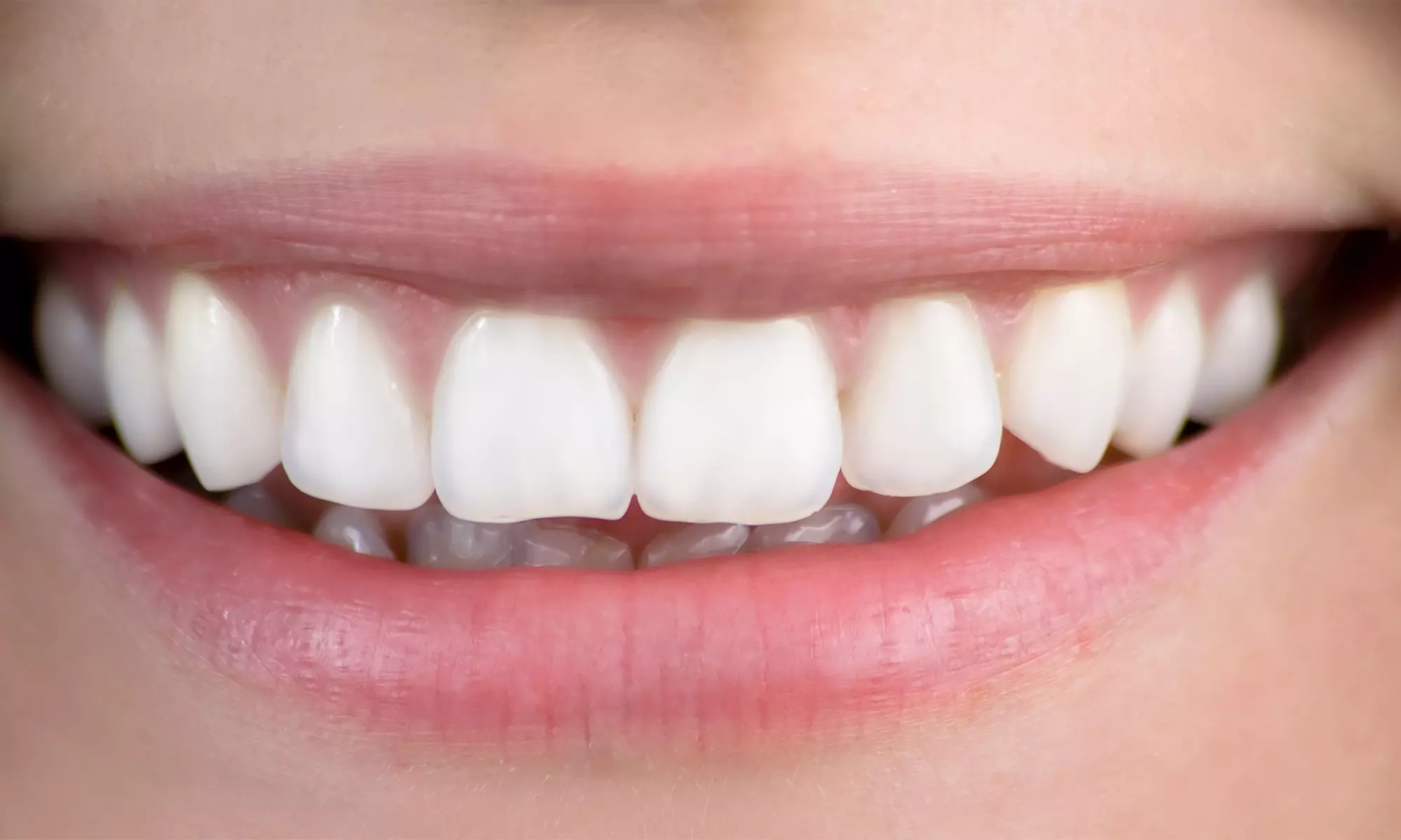 Exam, X-Ray, and Cleaning with Optional Enamel Strengthening Treatment at Abington Smile Center (Up to 71% Off) - Primary Image