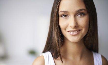 One session: Genesis laser facial on the full face - Skin Clique Laser Clinic