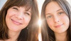 Up to 30% Off on Micro-Needling at Kari coiffure
