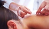 Traditional Chinese Diagnosis & Acupuncture Sessions at Tian Chao Herbs & Acupuncture at Up to 55% Off