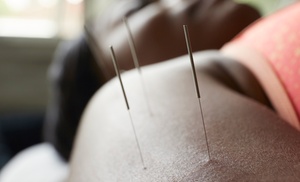 Acupuncture Sessions