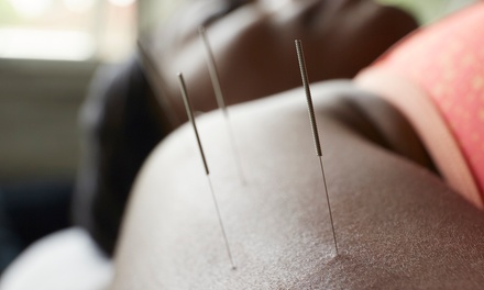 One session of acupuncture or cupping with consultation - Meridian Movement