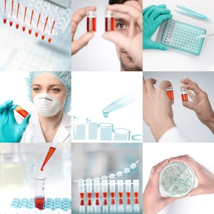 PDGF+ for Face Rejuvenation, Red light Therapy and Consultation - Vitality Vision Med Spa & Wellness